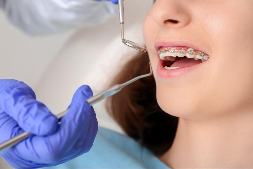 The Best Age to Start Orthodontic Treatment in Littleton