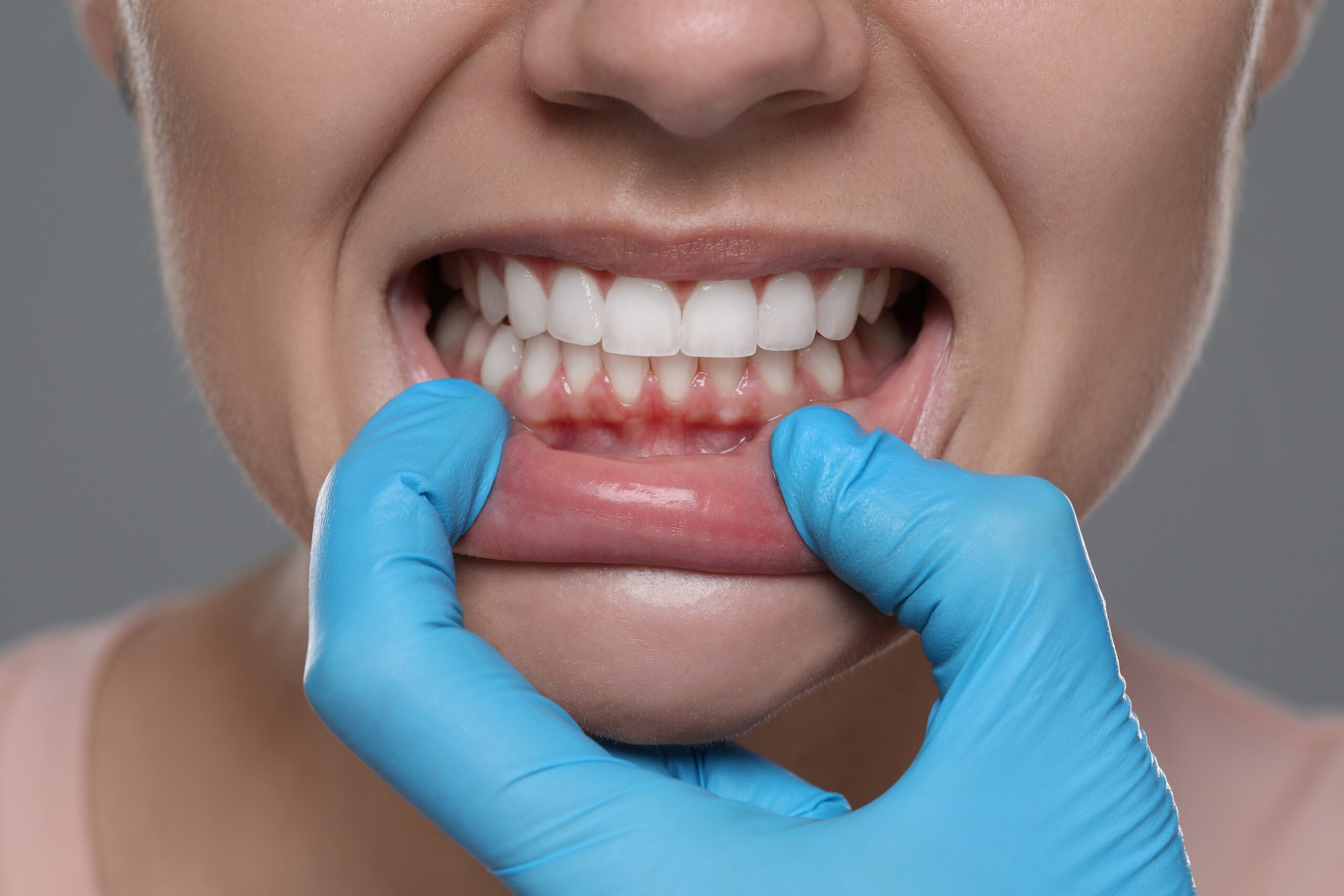 Woman,Showing,Healthy,Gums,On,Gray,Background,,Closeup littleton kids dentist