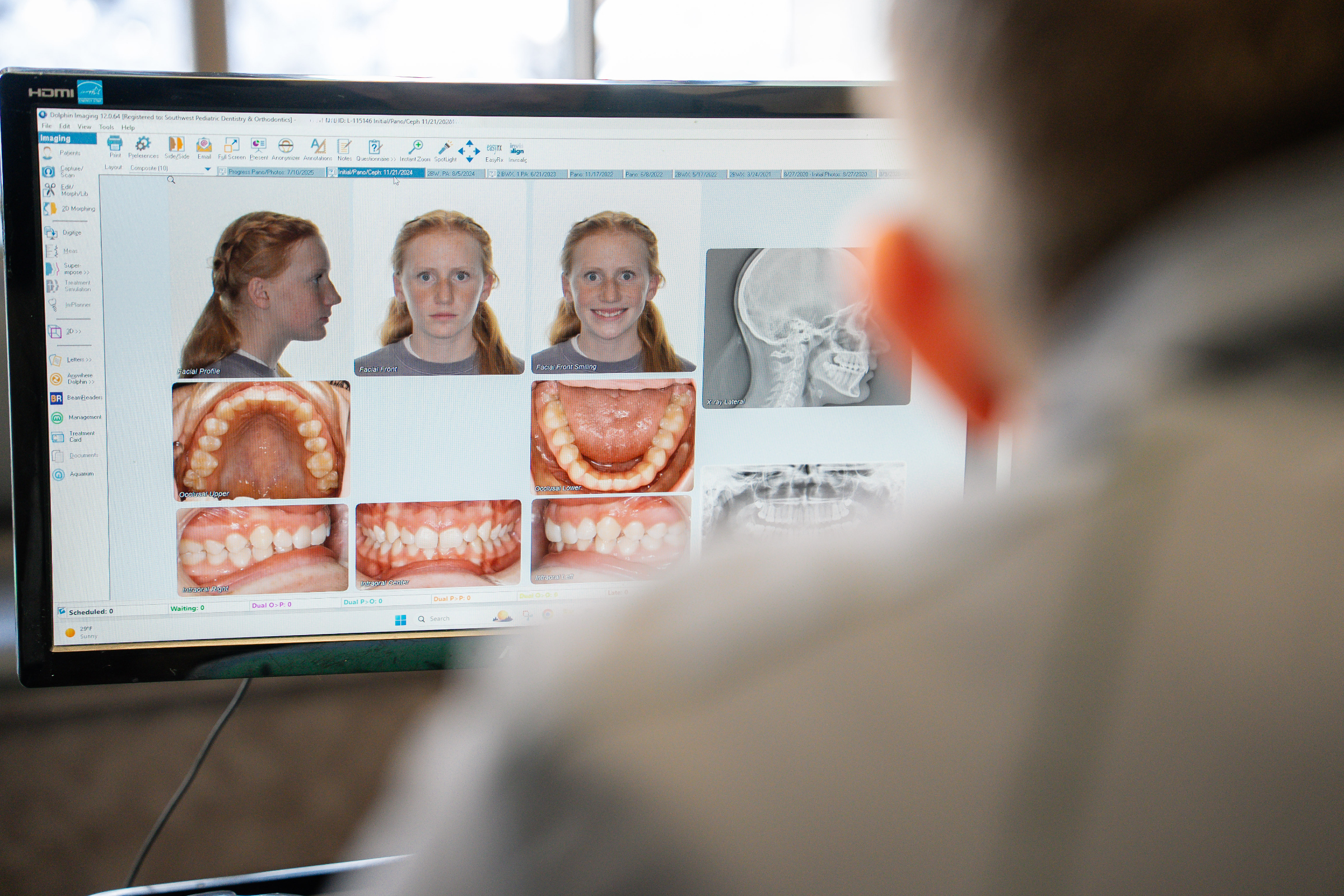 Dental Emergencies