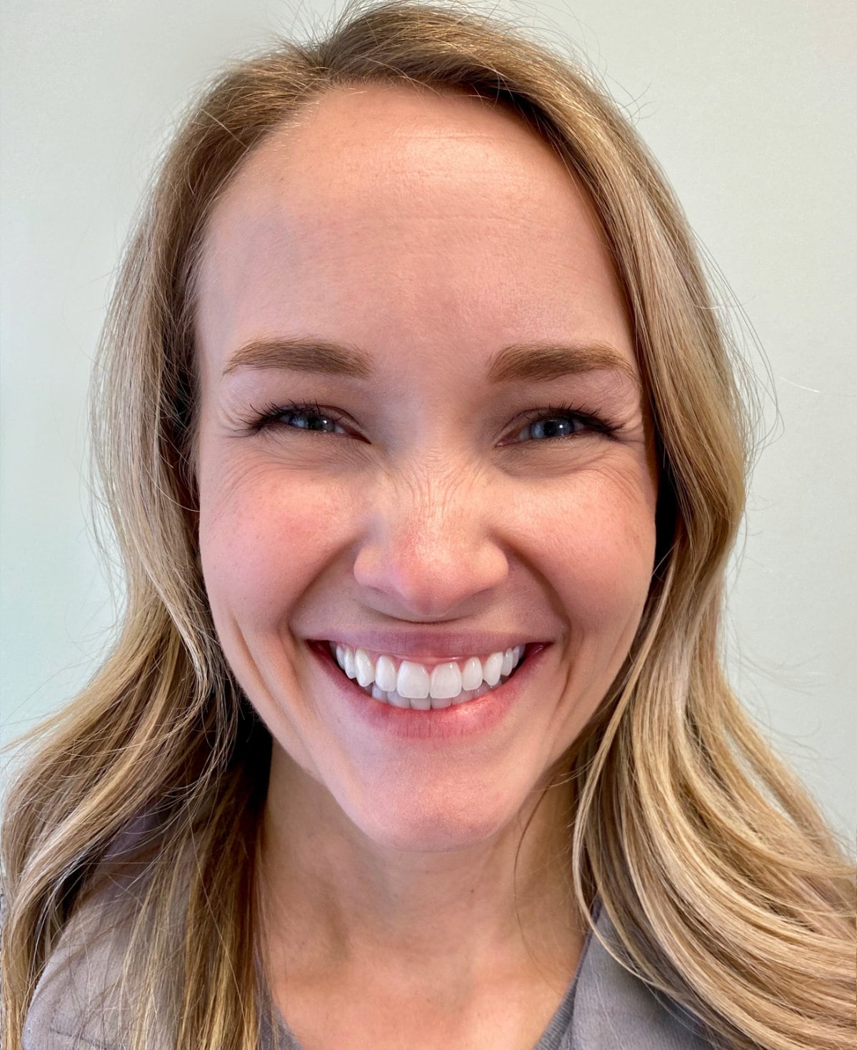 Smiling woman showcasing healthy teeth for virtual orthodontic consultation at Southwest Pediatric Dentistry & Orthodontics in Littleton.