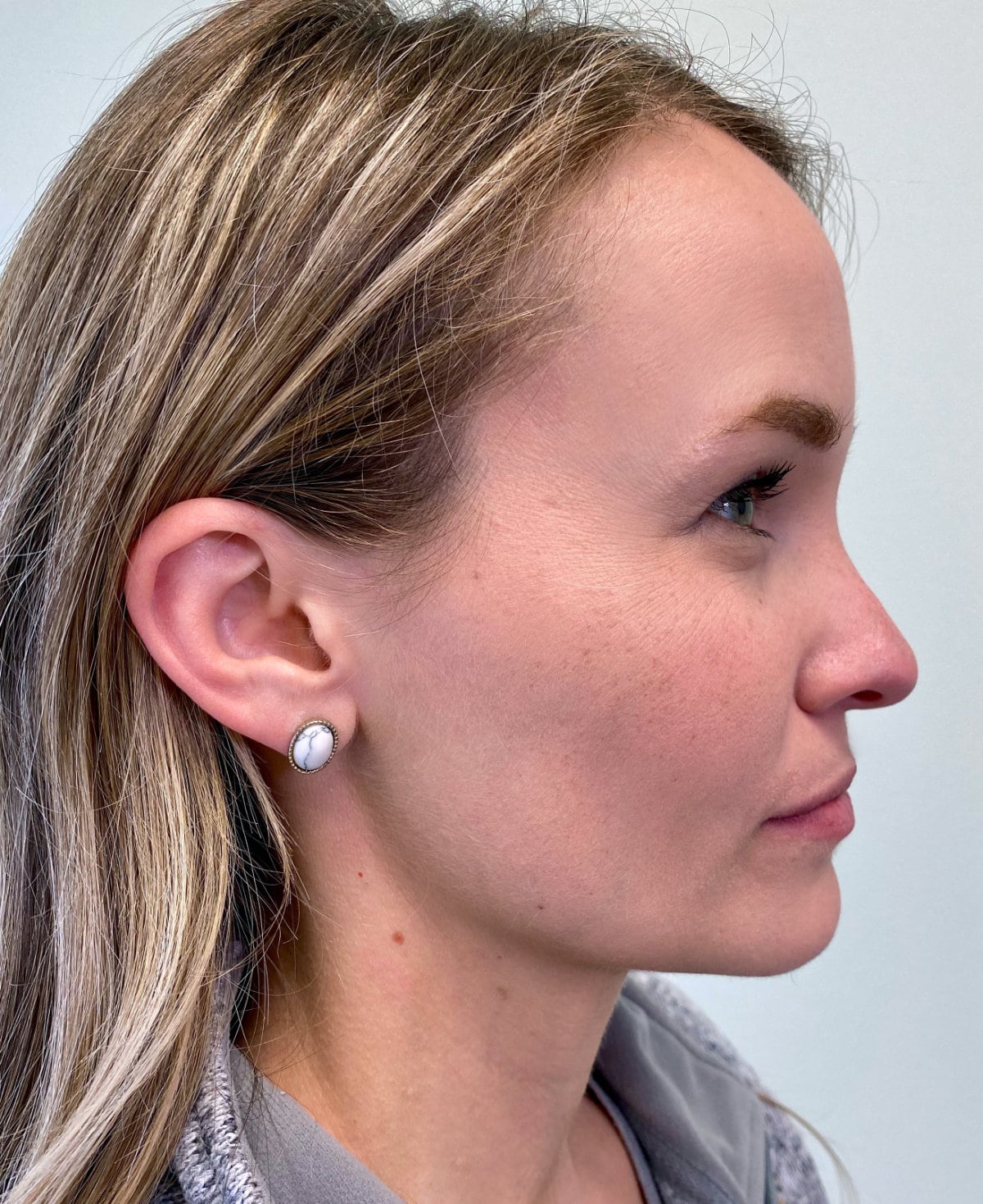 Profile view of a young woman for virtual orthodontic consultation at Southwest Pediatric Dentistry & Orthodontics in Littleton.